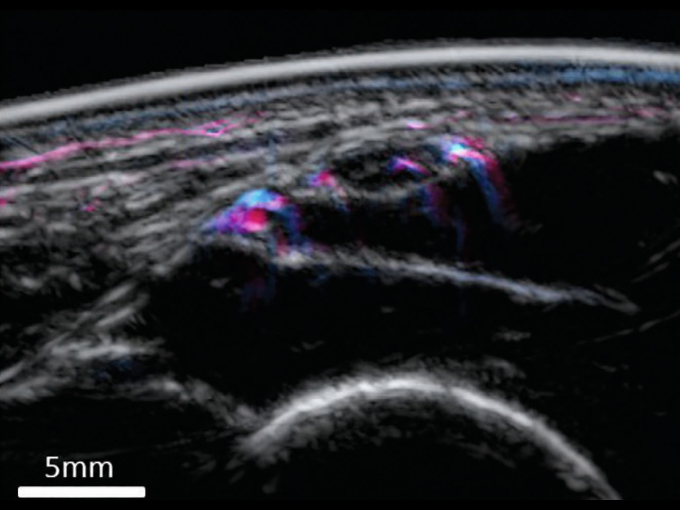 Peripheral nerves