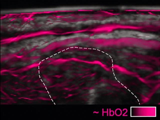 Thyroid - Noltes et al.