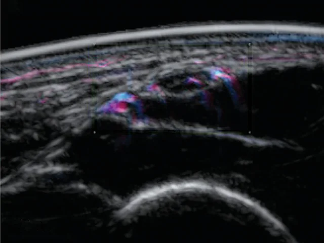 Peripheral nerves - Jüstel et al.